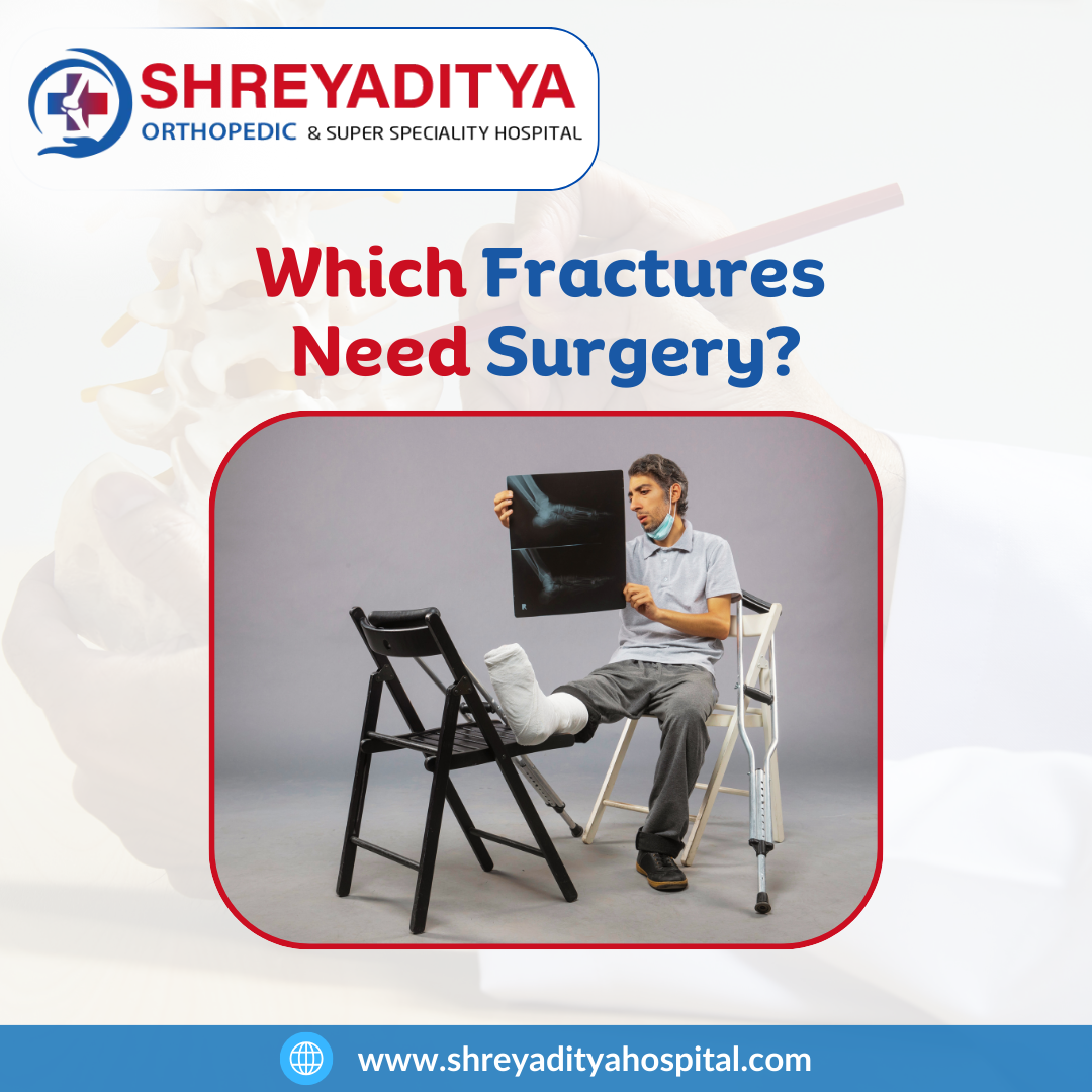 Which Fractures Need Surgery?